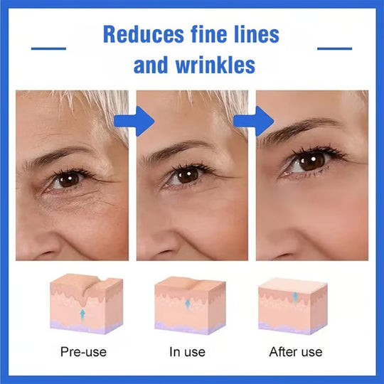 Hüaluroonhappe essents💦