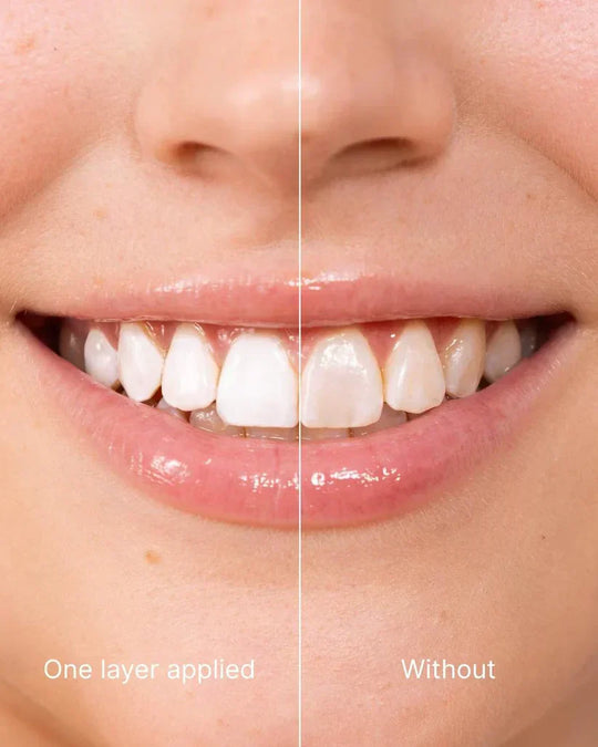 🖤2026 New Year · 40% OFF🖤Tooth Polish - Instant Clean Smile