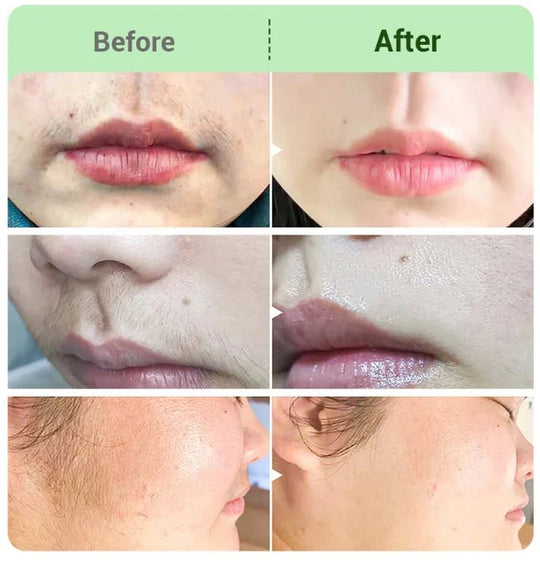 🤩Hair Removal Cream for Women