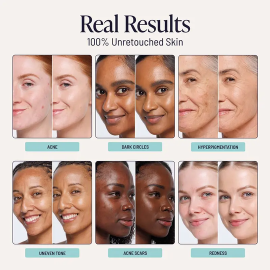 Supreme Cream Buildable Skin Tint + Free Foundation Brush
