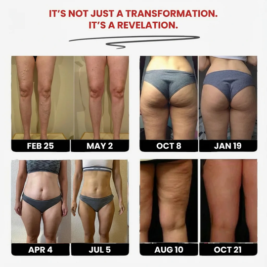 High-Waist Tummy Control & Butt Lifting POWERCELLS™ 3D Metabolic Booster Leggings