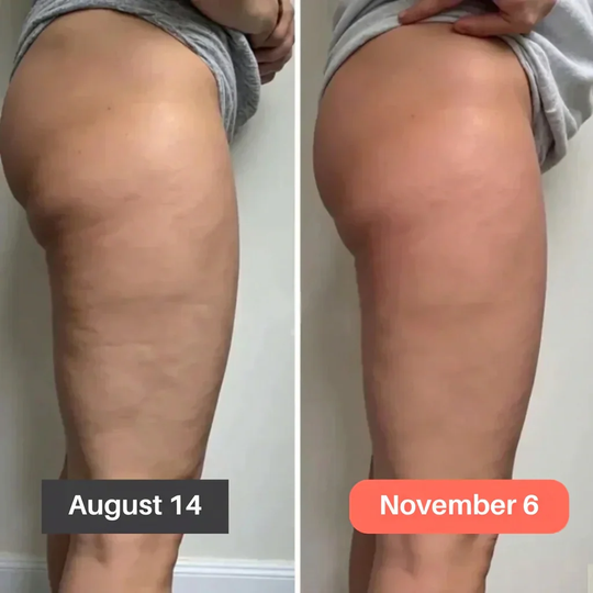 High-Waist Tummy Control & Butt Lifting POWERCELLS™ 3D Metabolic Booster Leggings