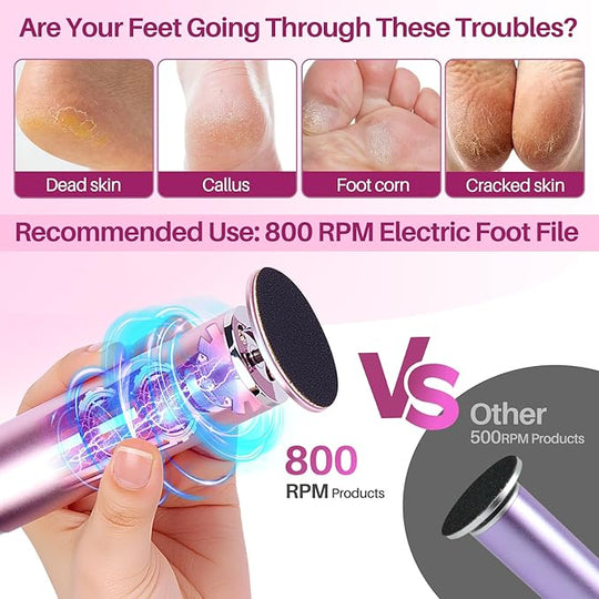 LIONVISON Electric Foot Callus Remover