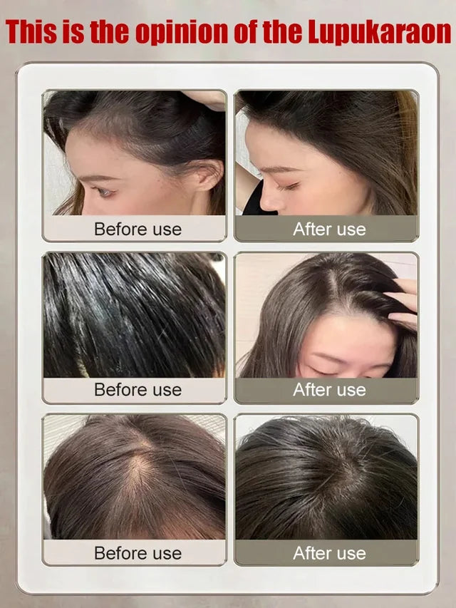 Clinical-grade anti-hair loss and hair growth serum