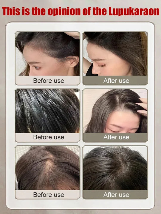 Clinical-grade anti-hair loss and hair growth serum