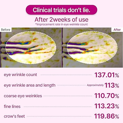 Dr.Melaxin Calcium Volume Eye Patches – Firming Hydrogel Under Eye Masks for Puffiness Fine Lines, Deep Hydration