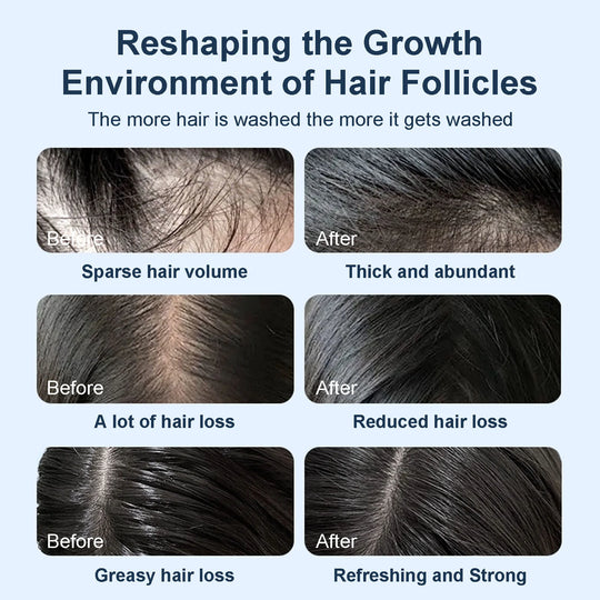 Rozmarýnový šampon Tgideas