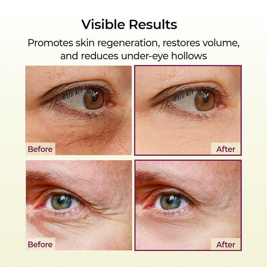 [Dr.Melaxin Official] Cemenrete Calcium Multi Balm | Anti-aging, Sagging,Wrinkles | Korean Cosmetics