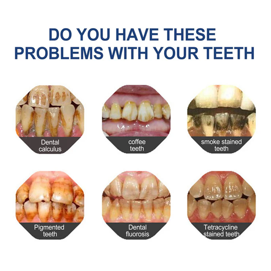 🖤Black Friday Sale:40% OFF🖤YaGoo™ Fluoride-Free Hydroxyapatite Toothpaste – Gentle Whitening & Enamel Strength for Sensitive Teeth