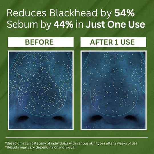 P.CALM Holy Basil Carbonated Mask: Transforming Clay-to-Bubbles Deep Pore Cleanser, Blackhead & Sebum Control, 90g Spa Experience Makeup&nbsp;Organizers