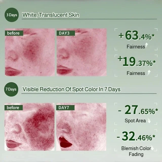 Whitening Moisturizing Essence Spray