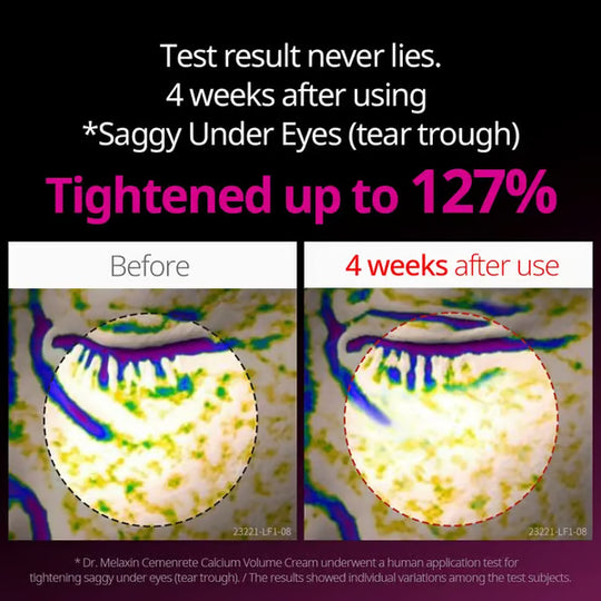 🔥Christmas Discount 49% Off🎄Calcium Concentrated Repair Cream