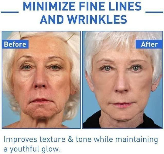 Botox Anti-Aging Serum🔥