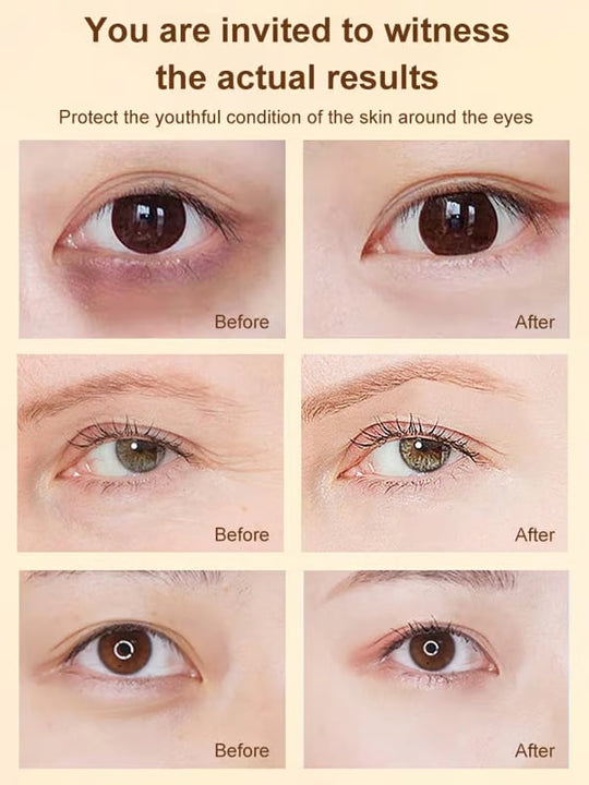 Dinkiss Lutein Eye Essence Oil