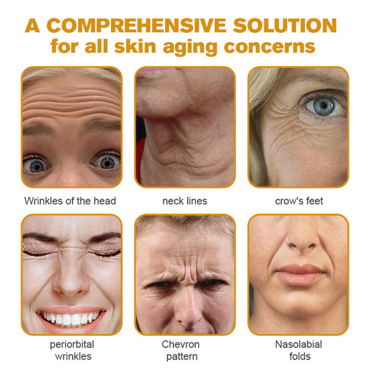 🖤Black Friday Sale:50% OFF🖤🧑‍⚕️TLOPA® Botox Bee Venom Wrinkle Removal Cream🔥