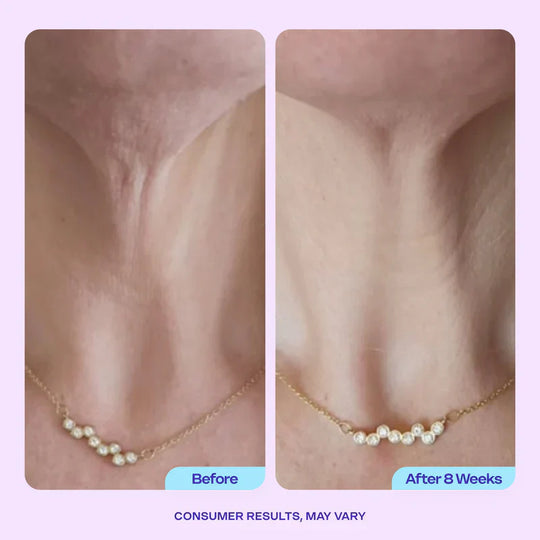 Advanced Firming Neck Cream – Visibly Lifts & Tightens "Turkey
