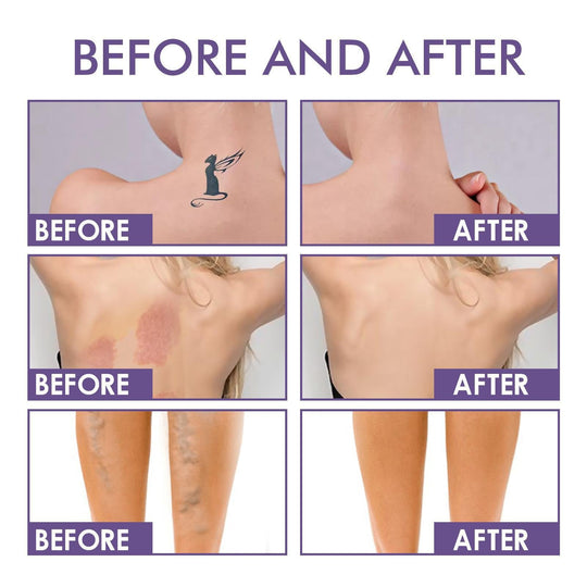 💜Free brushes💜Body Coverage Perfector – Waterproof, Lightweight & Flawless Body Makeup