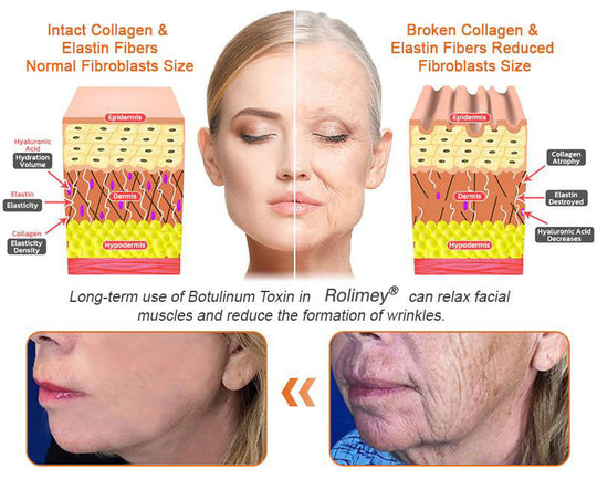 🧑‍⚕️𝑶𝒇𝒇𝒊𝒄𝒊𝒂𝒍 𝑺𝒕𝒐𝒓𝒆 | 𝐑𝐨𝐥𝐢𝐦𝐞𝐲® 𝐁𝐨𝐭𝐨𝐱 𝐁𝐞𝐞 𝐕𝐞𝐧𝐨𝐦 𝐅𝐢𝐫𝐦𝐢𝐧𝐠 𝐒𝐞𝐫𝐮𝐦 𝐒𝐭𝐢𝐜𝐤 - 𝐓𝐚𝐫𝐠𝐞𝐭𝐬 𝐒𝐚𝐠𝐠𝐢𝐧𝐠 𝐒𝐤𝐢𝐧 & 𝐖𝐫𝐢𝐧𝐤𝐥𝐞𝐬 𝐀𝐥𝐥 𝐎𝐯𝐞𝐫 𝐁𝐨𝐝𝐲 𝐰𝐢𝐭𝐡 𝐀𝐝𝐯𝐚𝐧𝐜𝐞𝐝 𝐏𝐞𝐩𝐭𝐢𝐝𝐞 𝐓𝐞𝐜𝐡𝐧𝐨𝐥𝐨𝐠𝐲, 𝐕𝐢𝐬𝐢𝐛𝐥𝐞 𝐑𝐞𝐬𝐮𝐥𝐭𝐬 𝐢𝐧 𝟑 𝐃𝐚𝐲𝐬