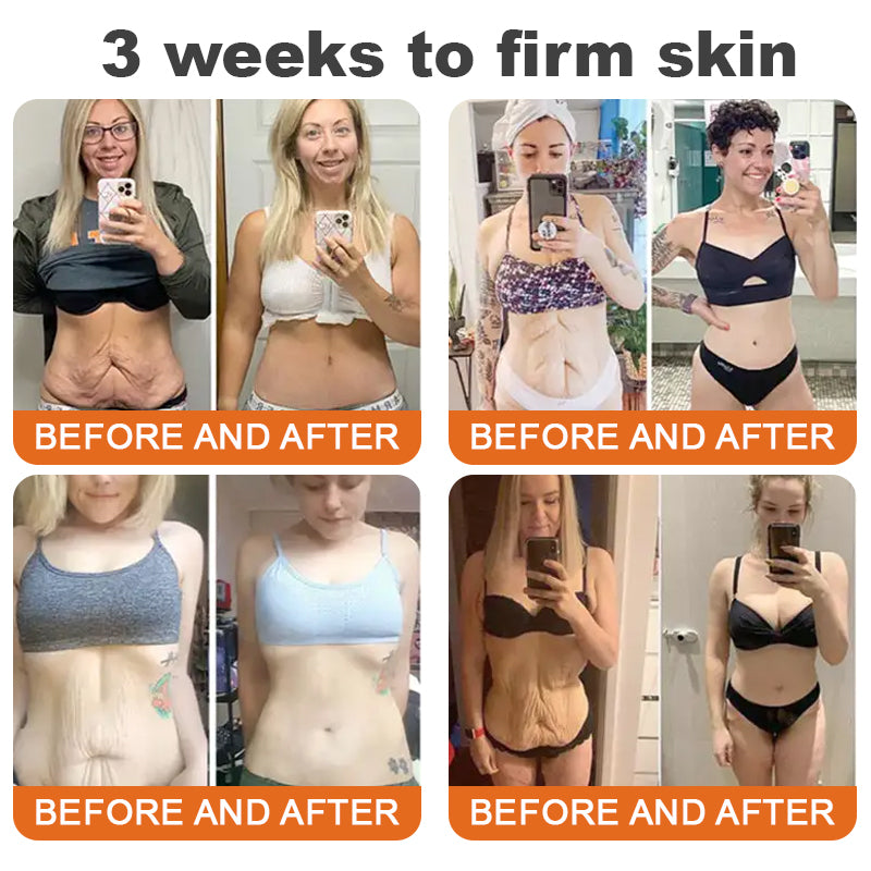 🧑‍⚕️𝑶𝒇𝒇𝒊𝒄𝒊𝒂𝒍 𝑺𝒕𝒐𝒓𝒆 | 𝐑𝐨𝐥𝐢𝐦𝐞𝐲® 𝐁𝐨𝐭𝐨𝐱 𝐁𝐞𝐞 𝐕𝐞𝐧𝐨𝐦 𝐅𝐢𝐫𝐦𝐢𝐧𝐠 𝐒𝐞𝐫𝐮𝐦 𝐒𝐭𝐢𝐜𝐤 - 𝐓𝐚𝐫𝐠𝐞𝐭𝐬 𝐒𝐚𝐠𝐠𝐢𝐧𝐠 𝐒𝐤𝐢𝐧 & 𝐖𝐫𝐢𝐧𝐤𝐥𝐞𝐬 𝐀𝐥𝐥 𝐎𝐯𝐞𝐫 𝐁𝐨𝐝𝐲 𝐰𝐢𝐭𝐡 𝐀𝐝𝐯𝐚𝐧𝐜𝐞𝐝 𝐏𝐞𝐩𝐭𝐢𝐝𝐞 𝐓𝐞𝐜𝐡𝐧𝐨𝐥𝐨𝐠𝐲, 𝐕𝐢𝐬𝐢𝐛𝐥𝐞 𝐑𝐞𝐬𝐮𝐥𝐭𝐬 𝐢𝐧 𝟑 𝐃𝐚𝐲𝐬