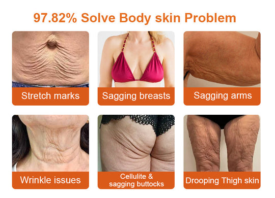 🧑‍⚕️𝑶𝒇𝒇𝒊𝒄𝒊𝒂𝒍 𝑺𝒕𝒐𝒓𝒆 | 𝐑𝐨𝐥𝐢𝐦𝐞𝐲® 𝐁𝐨𝐭𝐨𝐱 𝐁𝐞𝐞 𝐕𝐞𝐧𝐨𝐦 𝐅𝐢𝐫𝐦𝐢𝐧𝐠 𝐒𝐞𝐫𝐮𝐦 𝐒𝐭𝐢𝐜𝐤 - 𝐓𝐚𝐫𝐠𝐞𝐭𝐬 𝐒𝐚𝐠𝐠𝐢𝐧𝐠 𝐒𝐤𝐢𝐧 & 𝐖𝐫𝐢𝐧𝐤𝐥𝐞𝐬 𝐀𝐥𝐥 𝐎𝐯𝐞𝐫 𝐁𝐨𝐝𝐲 𝐰𝐢𝐭𝐡 𝐀𝐝𝐯𝐚𝐧𝐜𝐞𝐝 𝐏𝐞𝐩𝐭𝐢𝐝𝐞 𝐓𝐞𝐜𝐡𝐧𝐨𝐥𝐨𝐠𝐲, 𝐕𝐢𝐬𝐢𝐛𝐥𝐞 𝐑𝐞𝐬𝐮𝐥𝐭𝐬 𝐢𝐧 𝟑 𝐃𝐚𝐲𝐬