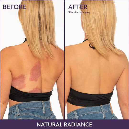 💜Free brushes💜Body Coverage Perfector – Waterproof, Lightweight & Flawless Body Makeup