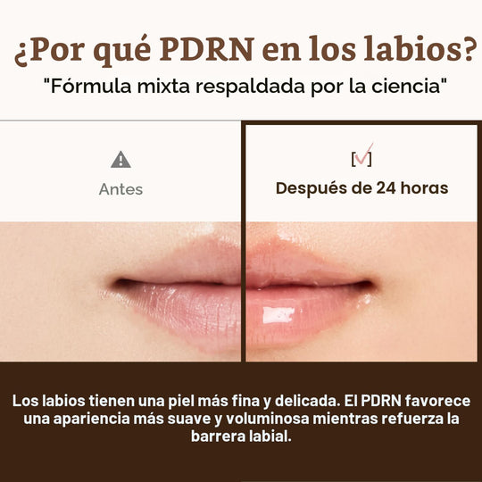 Dr. Reju-All Advanced PDRN - Rejuvenating Lip Serum - Moisturizing Lip Balm with Lipozip PDRN for Glossy, Dewy Lips - Gentle Exfoliating & Smoothing Lip Moisturizer - Hibiscus & Lactic Acid - 0.3 fl oz