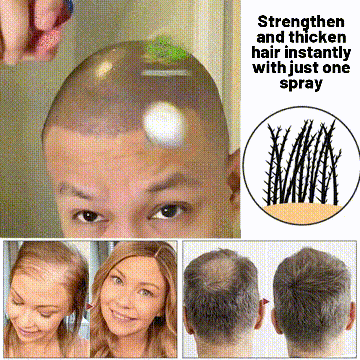 🖤Black Friday Sale:40% OFF🖤 HZA™ Natural Hair Regrowth Spray