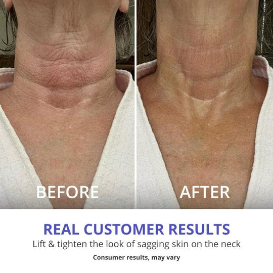 [GOPure official] Neck Cream Tighten & Lift Firming Cream for Crepey Skin Tightening Cosmetic - Clinically Proven, Safe & Clean, Dermatologist Recommended, Cruelty-Free