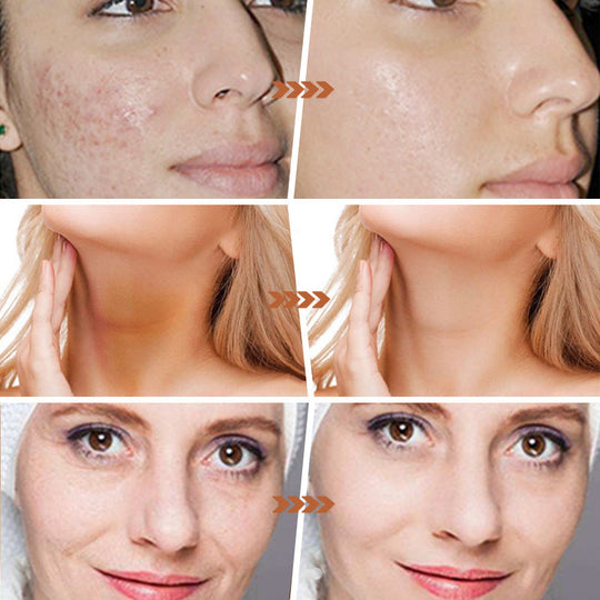 🧼Lemon Turmeric & Kojic Acid Soap Bars