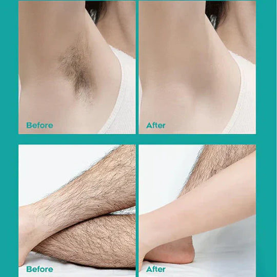 Painless Full Body Hair Removal Cream for Men & Women– Skin-friendly for all areas🌿