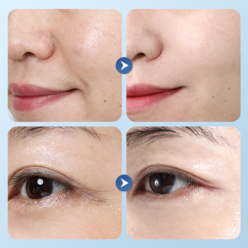 Collagen Anti-Wrinkle Serum